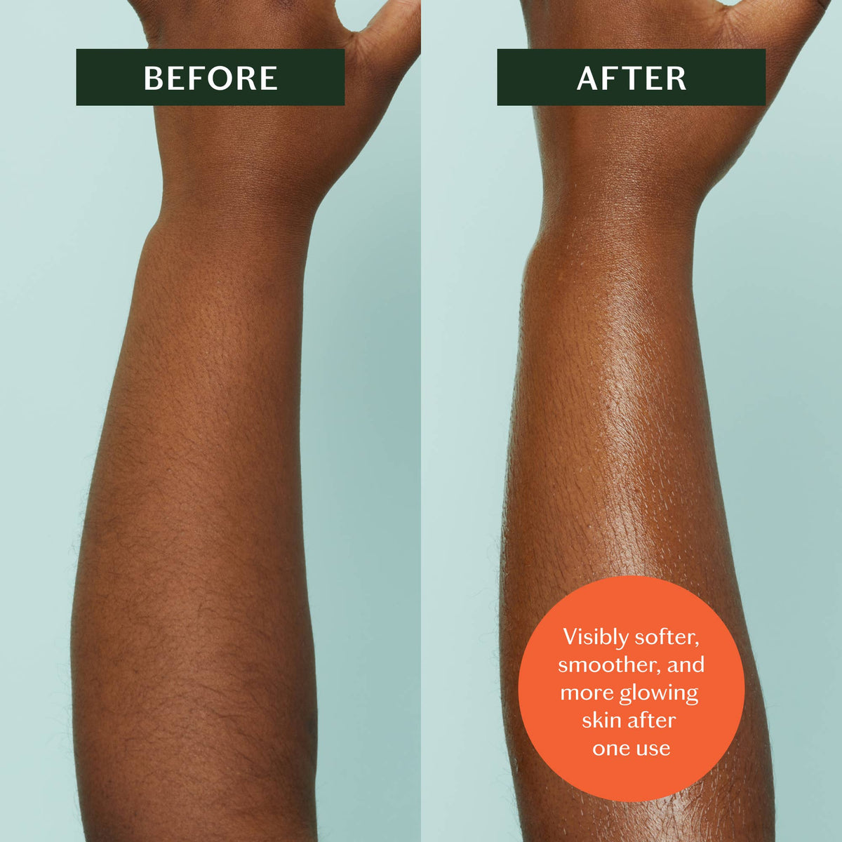 Before and after comparison of a person's arm with visible skin improvement.